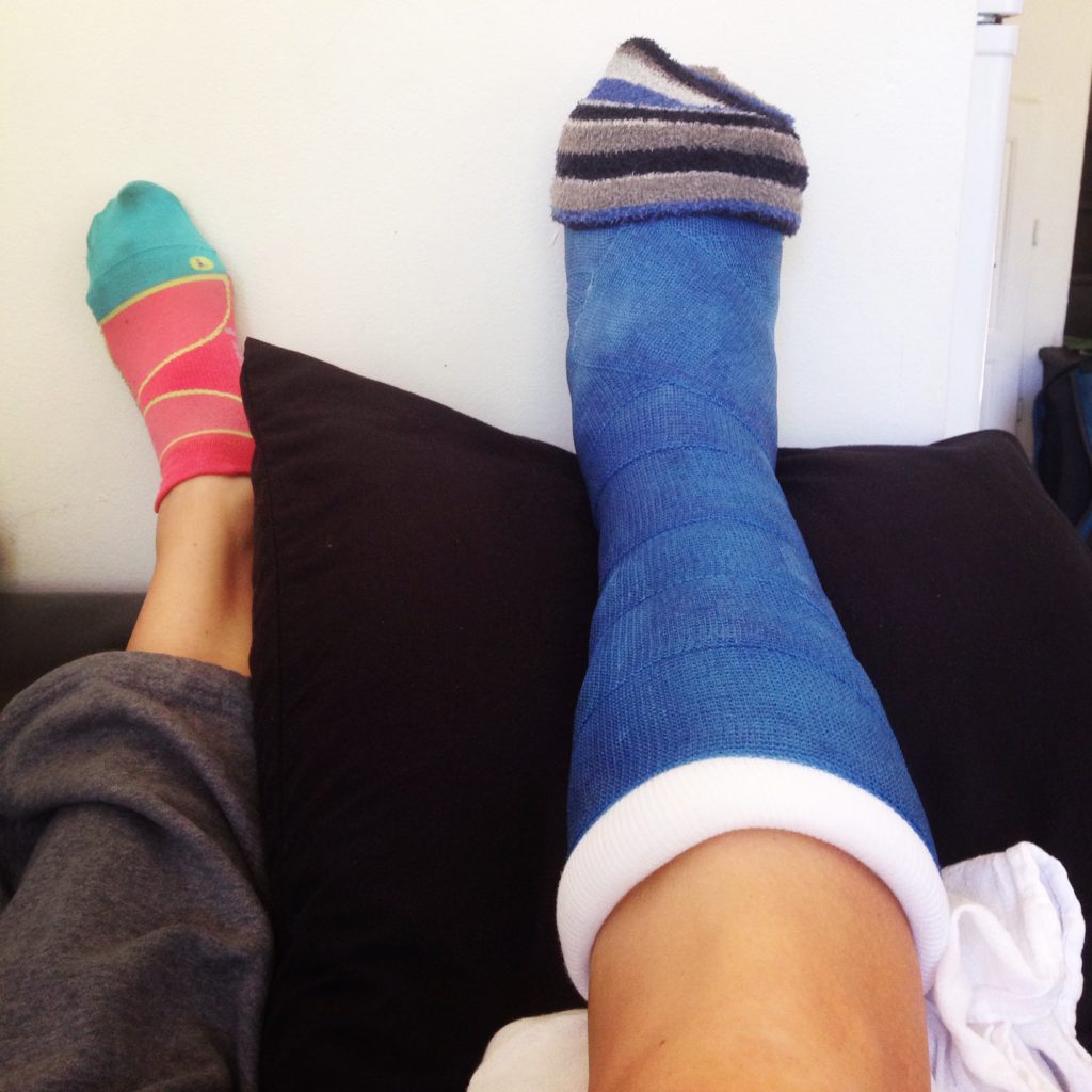 Peroneal Tendon Surgery Recovery -year-long injury